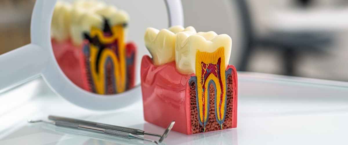 The Role of Biofilm in Gum Disease and Cavities